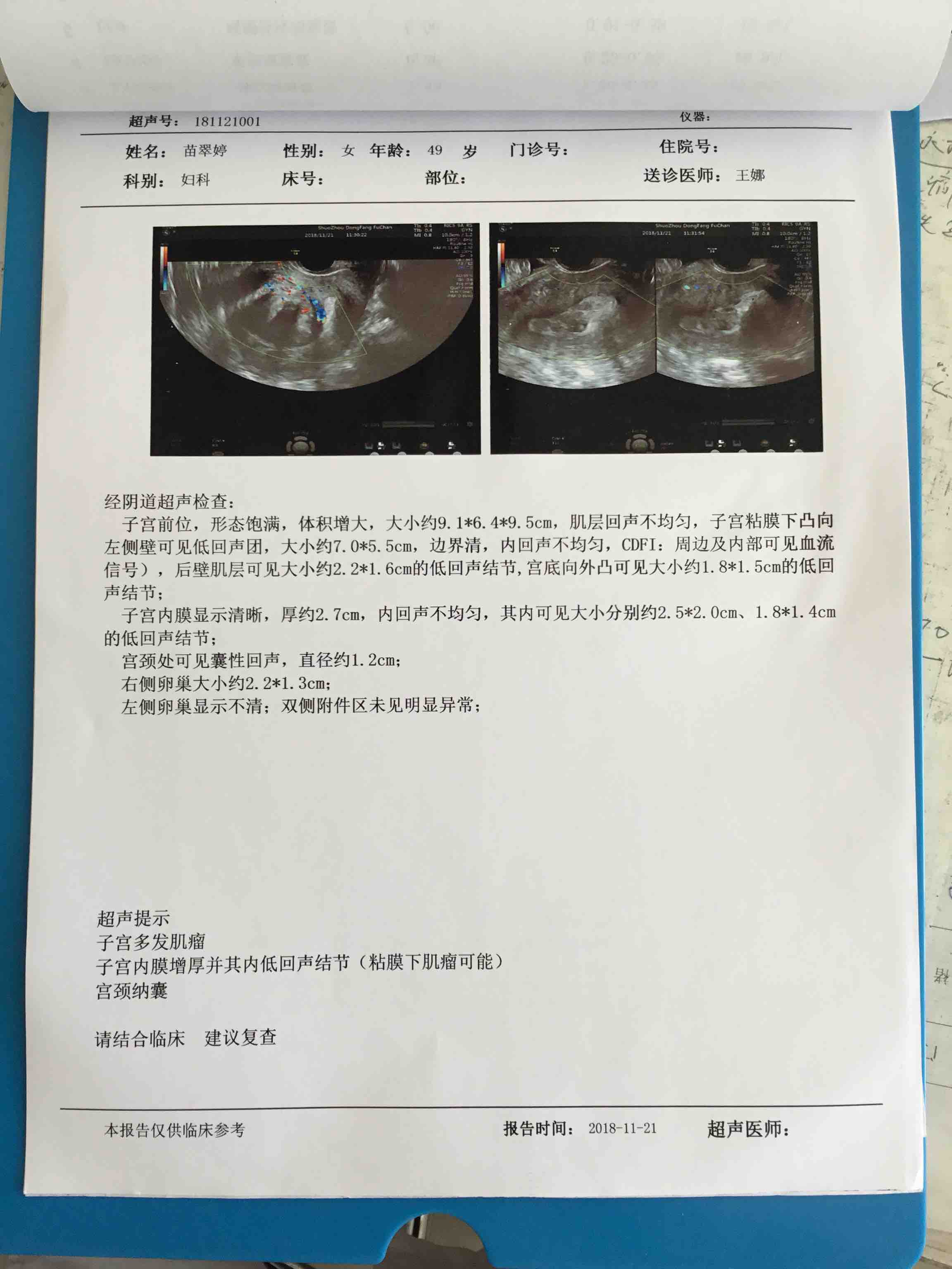病例6-13 子宫肌瘤(13)-超声读片-医学