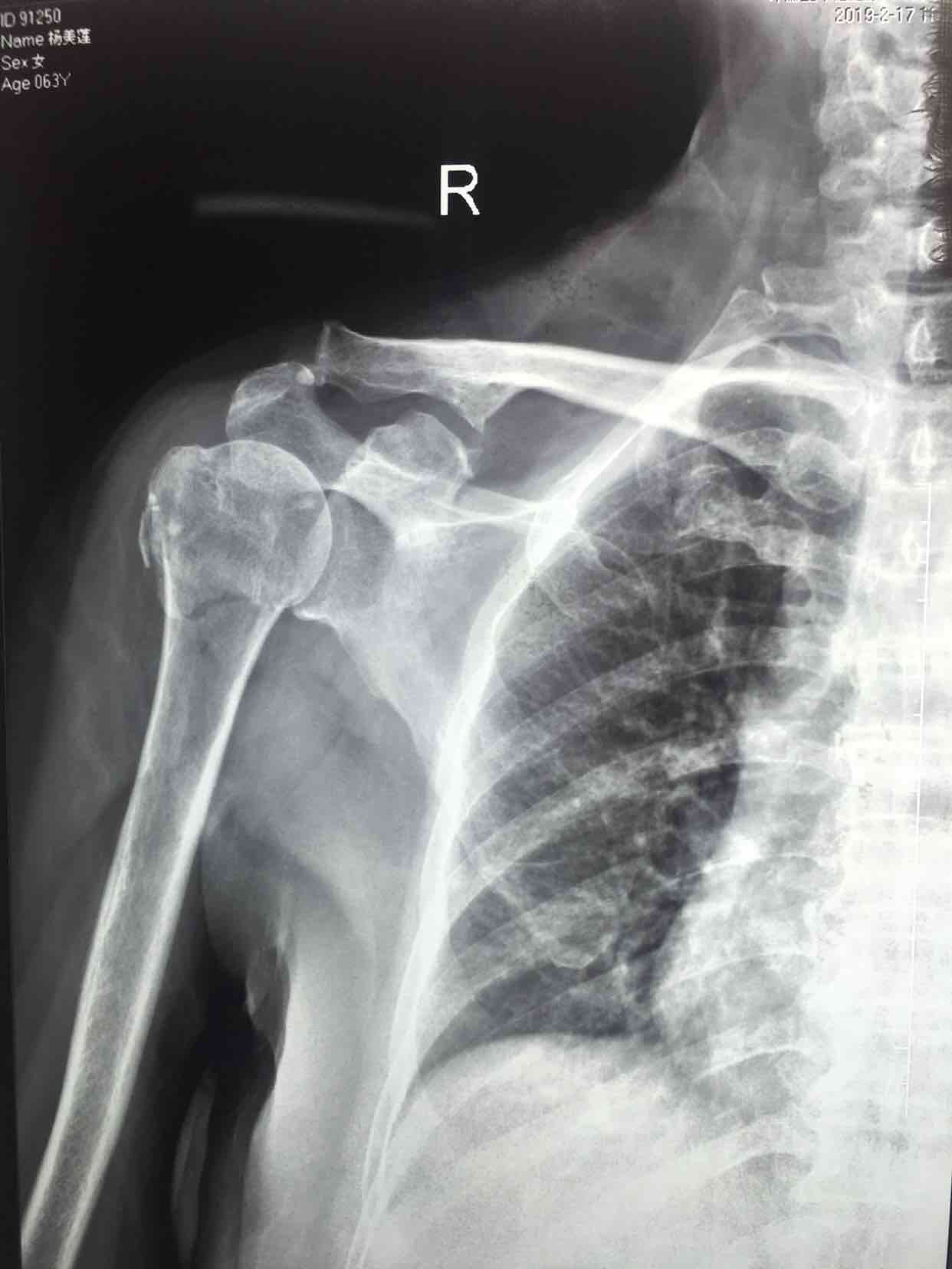 图4-4 肱骨-外科学-医学